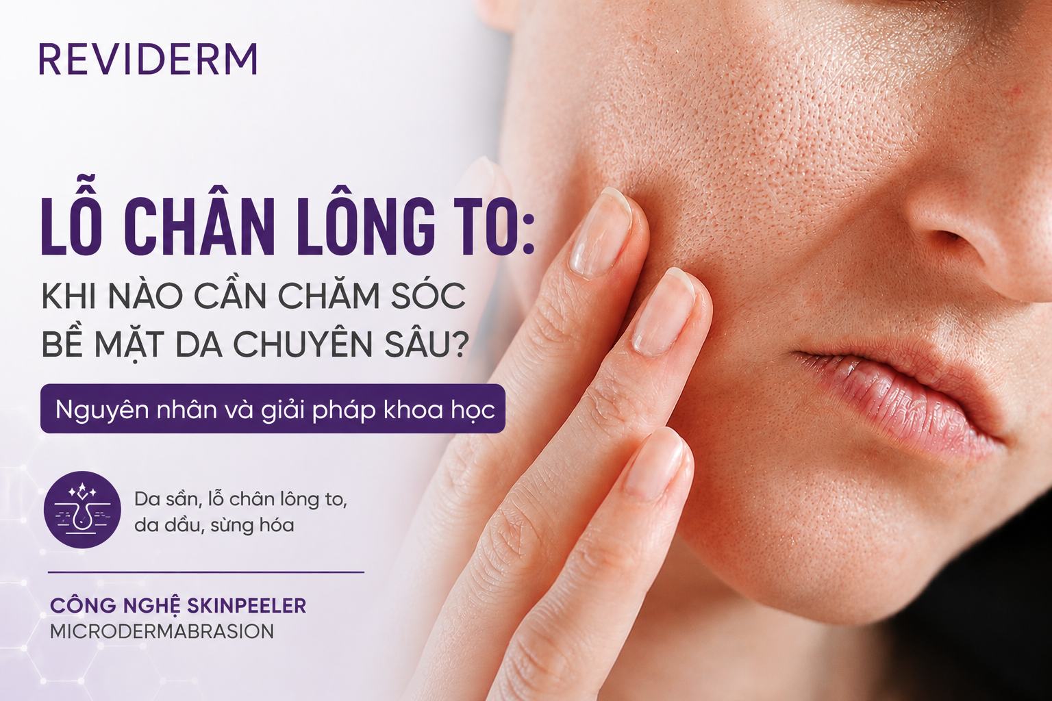 Lỗ chân lông to: Khi nào cần chăm sóc bề mặt da chuyên sâu?