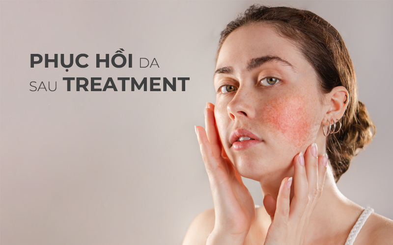 Phục hồi da sau treatment